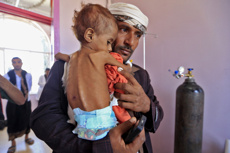 Vier von fünf Jemeniten sind auf Hilfe angewiesen. In diesem Krieg sterben mehr Menschen an Hunger und dessen Folgen als an Waffengewalt. Besonders Kinder leiden.