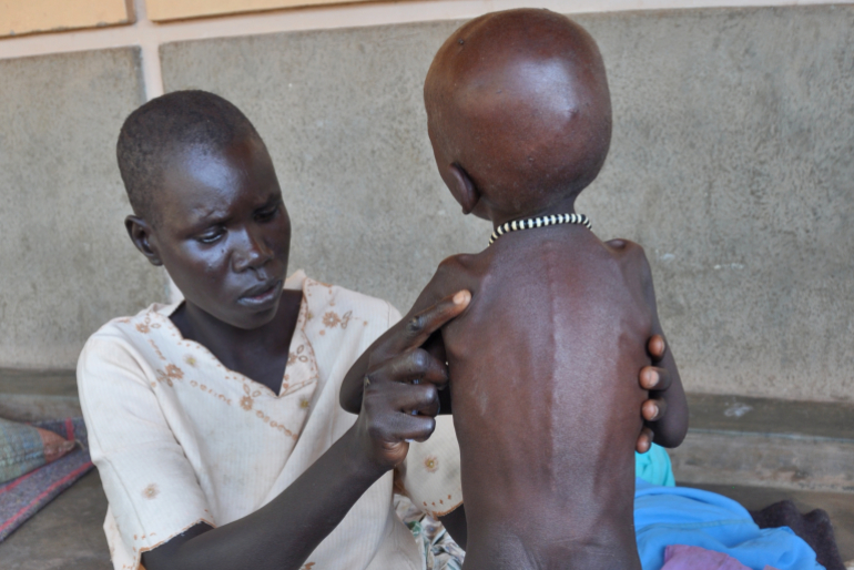 Seine Mutter Kuei Tong setzt ihre ganze Hoffnung auf die Behandlung in der Klinik. Monyping leidet unter Malaria, vermutlich auch ein Grund seiner starken Unterernährung.