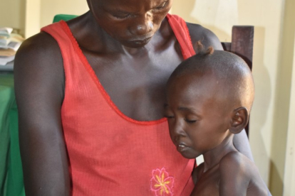 Atong Diing (2) leidet Qualen. Hunger und Krankheit rauben dem Mädchen die letzten Kräfte.